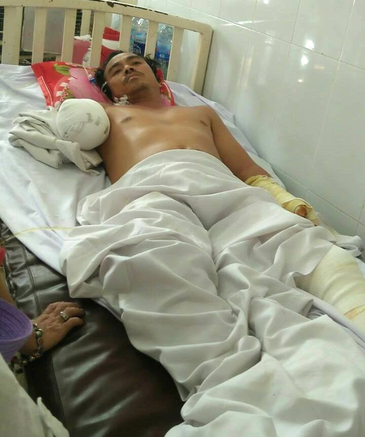 Xin giúp đỡ anh Cường bị điện giật